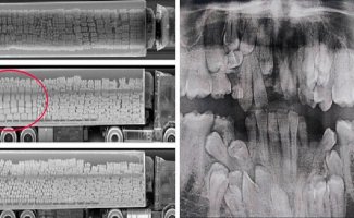 Рентгеновские снимки, которые открывают мир с неожиданной стороны (36 фото)